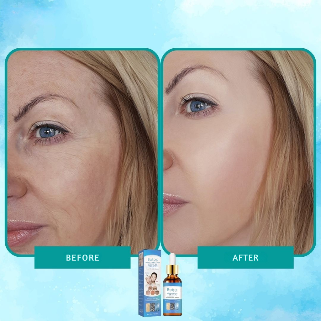 Intense anti-wrinkle Botox serum elixir 