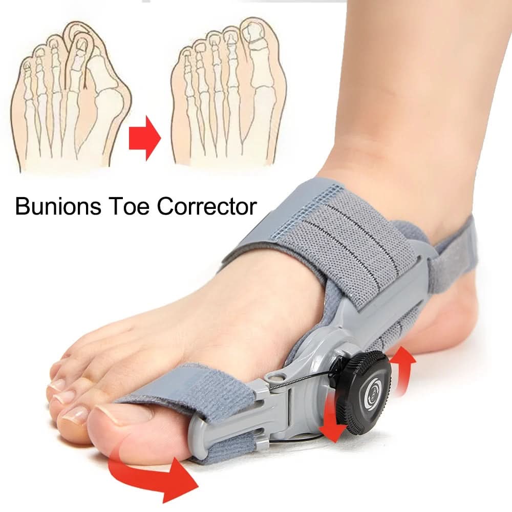 Korrigera dina hallux valgus utan smärta eller operation 